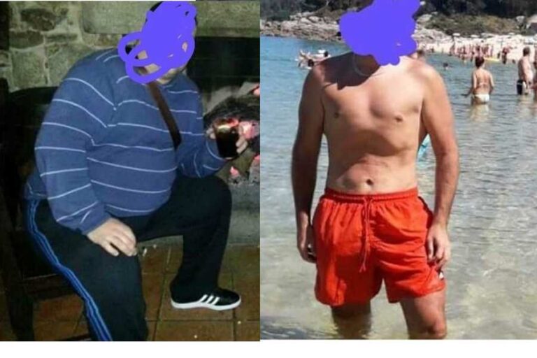 antes y después de Tony Calderón